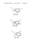 TISSUE RESECTION DEVICE AND RELATED METHODS OF USE diagram and image