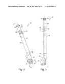 METHOD OF SURGICALLY PREPARING A PATIENT S FEMUR diagram and image