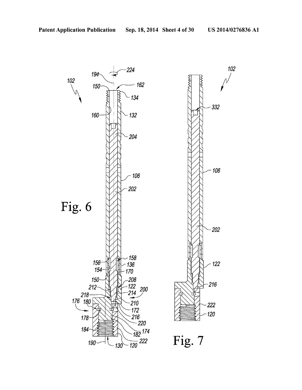 METHOD OF SURGICALLY PREPARING A PATIENT'S FEMUR - diagram, schematic, and image 05