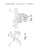 METHOD OF SURGICALLY PREPARING A PATIENT S FEMUR diagram and image