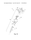 METHOD OF SURGICALLY PREPARING A PATIENT S FEMUR diagram and image