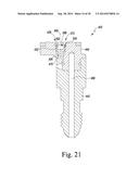 METHOD OF SURGICALLY PREPARING A PATIENT S FEMUR diagram and image