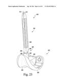 METHOD OF SURGICALLY PREPARING A PATIENT S FEMUR diagram and image