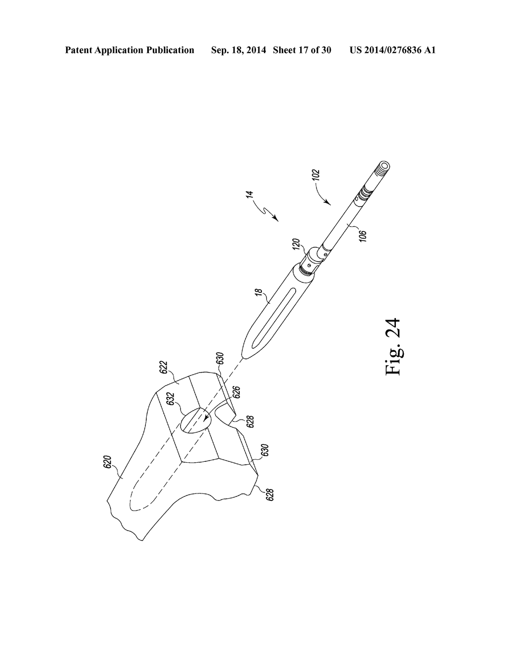 METHOD OF SURGICALLY PREPARING A PATIENT'S FEMUR - diagram, schematic, and image 18