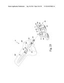 METHOD OF SURGICALLY PREPARING A PATIENT S FEMUR diagram and image