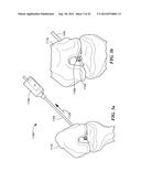 RETRO GUIDEWIRE REAMER diagram and image