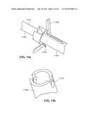 RETRO GUIDEWIRE REAMER diagram and image