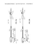 RETRO GUIDEWIRE REAMER diagram and image