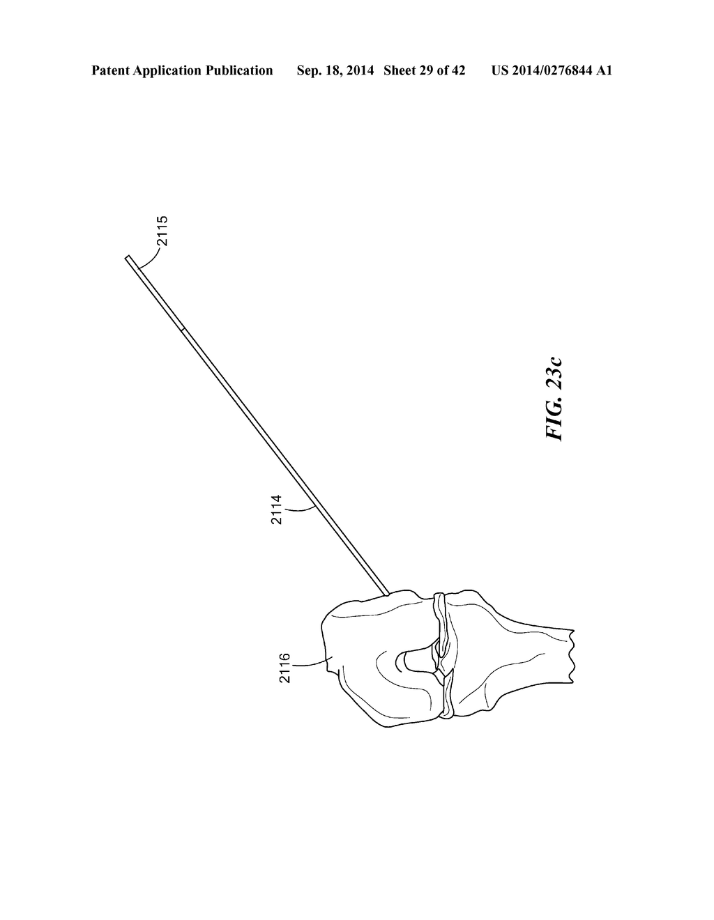 RETRO GUIDEWIRE REAMER - diagram, schematic, and image 30