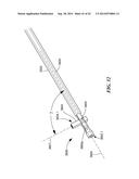 RETRO GUIDEWIRE REAMER diagram and image