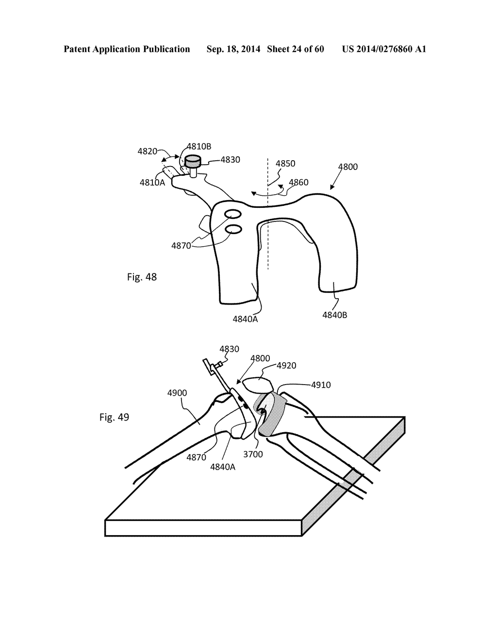 SYSTEM AND METHOD FOR ASSESSING, MEASURING, AND CORRECTING AN     ANTERIOR-POSTERIOR BONE CUT - diagram, schematic, and image 25