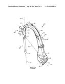 INTRAMEDULLARY NAIL HOLDING DEVICE diagram and image