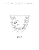 POSITIONING DEVICE FOR BONE DRILLING diagram and image