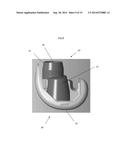 VOID FILLING JOINT PROSTHESIS AND ASSOCIATED INSTRUMENTS diagram and image