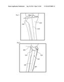 SYSTEM AND METHOD FOR MEASURING MUSCULAR-SKELETAL ALIGNMENT TO A     MECHANICAL AXIS diagram and image