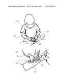 SYSTEM FOR SURGICAL INFORMATION AND FEEDBACK DISPLAY diagram and image