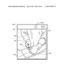 SYSTEM FOR SURGICAL INFORMATION AND FEEDBACK DISPLAY diagram and image