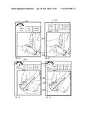 SYSTEM FOR SURGICAL INFORMATION AND FEEDBACK DISPLAY diagram and image