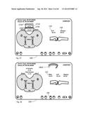 SYSTEM FOR SURGICAL INFORMATION AND FEEDBACK DISPLAY diagram and image