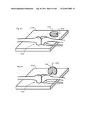 SYSTEM FOR SURGICAL INFORMATION AND FEEDBACK DISPLAY diagram and image