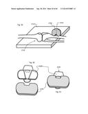 SYSTEM FOR SURGICAL INFORMATION AND FEEDBACK DISPLAY diagram and image