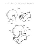 SYSTEM FOR SURGICAL INFORMATION AND FEEDBACK DISPLAY diagram and image