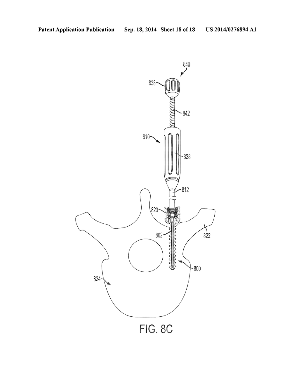 BONE ANCHORS AND SURGICAL INSTRUMENTS WITH INTEGRATED GUIDE TIPS - diagram, schematic, and image 19