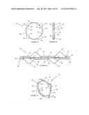 IRIS EXPANDER diagram and image