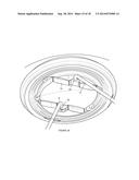 IRIS EXPANDER diagram and image