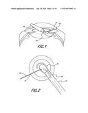 INTRAOCULAR LENS INSERTERS diagram and image