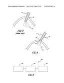 INTRAOCULAR LENS INSERTERS diagram and image