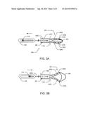 RESECTION DEVICE WITH SUPPORT MECHANISM AND RELATED METHODS OF USE diagram and image