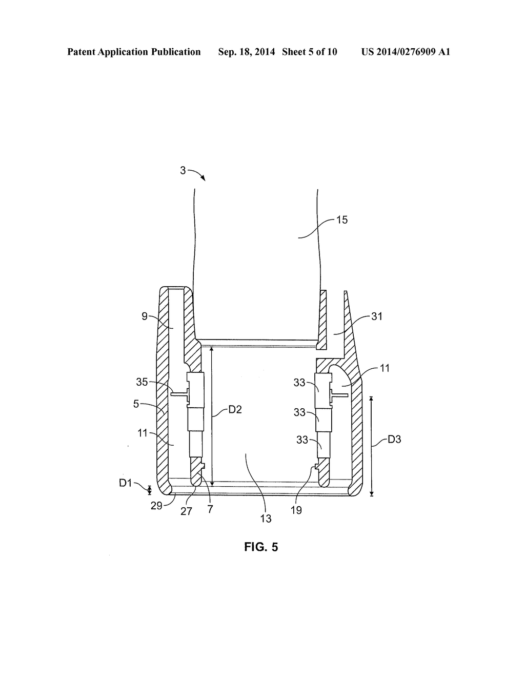 APPARATUS FOR TISSUE DISSECTION WITH SUCTION RING - diagram, schematic, and image 06