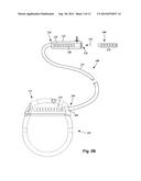 SYSTEM AND METHOD FOR MAKING AND USING A LEAD INTRODUCER FOR AN     IMPLANTABLE ELECTRICAL STIMULATION SYSTEM diagram and image