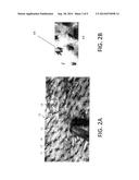 System and Method for Determining the Position of a Hair Tail on a Body     Surface diagram and image