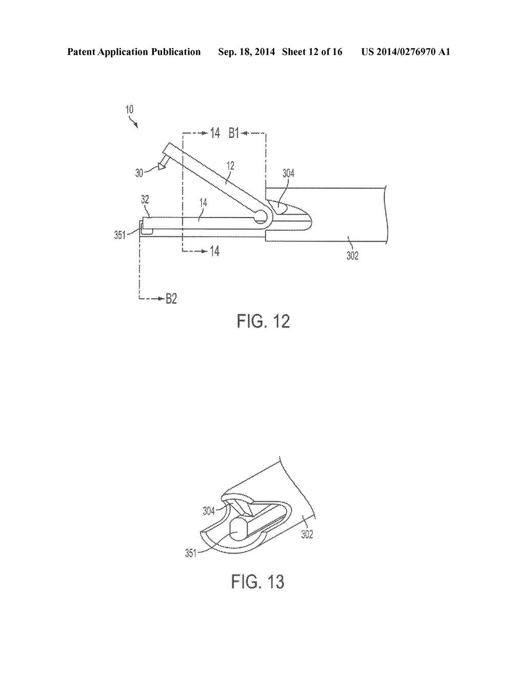 MECHANICAL FASTENERS FOR USE WITH SURGICAL ENERGY DEVICES - diagram, schematic, and image 13