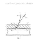 LARGE BORE CLOSURE SECONDARY HEMOSTASIS BIOADHESIVE DELIVERY SYSTEMS AND     METHODS diagram and image