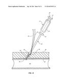 LARGE BORE CLOSURE SECONDARY HEMOSTASIS BIOADHESIVE DELIVERY SYSTEMS AND     METHODS diagram and image