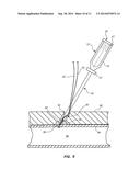 LARGE BORE CLOSURE SECONDARY HEMOSTASIS BIOADHESIVE DELIVERY SYSTEMS AND     METHODS diagram and image