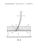 LARGE BORE CLOSURE SECONDARY HEMOSTASIS BIOADHESIVE DELIVERY SYSTEMS AND     METHODS diagram and image