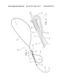 METHOD AND DEVICES FOR SECURING BIDIRECTIONAL SUTURE LOOPS USING COAXIAL     MECHANICAL FASTENERS diagram and image