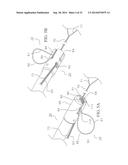 METHOD AND DEVICES FOR SECURING BIDIRECTIONAL SUTURE LOOPS USING COAXIAL     MECHANICAL FASTENERS diagram and image