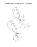 METHOD AND DEVICES FOR SECURING BIDIRECTIONAL SUTURE LOOPS USING COAXIAL     MECHANICAL FASTENERS diagram and image