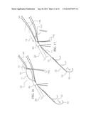 METHOD AND DEVICES FOR SECURING BIDIRECTIONAL SUTURE LOOPS USING COAXIAL     MECHANICAL FASTENERS diagram and image