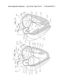 METHOD AND DEVICES FOR SECURING BIDIRECTIONAL SUTURE LOOPS USING COAXIAL     MECHANICAL FASTENERS diagram and image