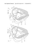 METHOD AND DEVICES FOR SECURING BIDIRECTIONAL SUTURE LOOPS USING COAXIAL     MECHANICAL FASTENERS diagram and image