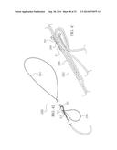 METHOD AND DEVICES FOR SECURING BIDIRECTIONAL SUTURE LOOPS USING COAXIAL     MECHANICAL FASTENERS diagram and image