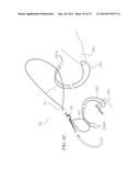 METHOD AND DEVICES FOR SECURING BIDIRECTIONAL SUTURE LOOPS USING COAXIAL     MECHANICAL FASTENERS diagram and image