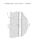 Suturing Device and Method for Sealing an Opening in a Blood Vessel or     Other Biological Structure diagram and image