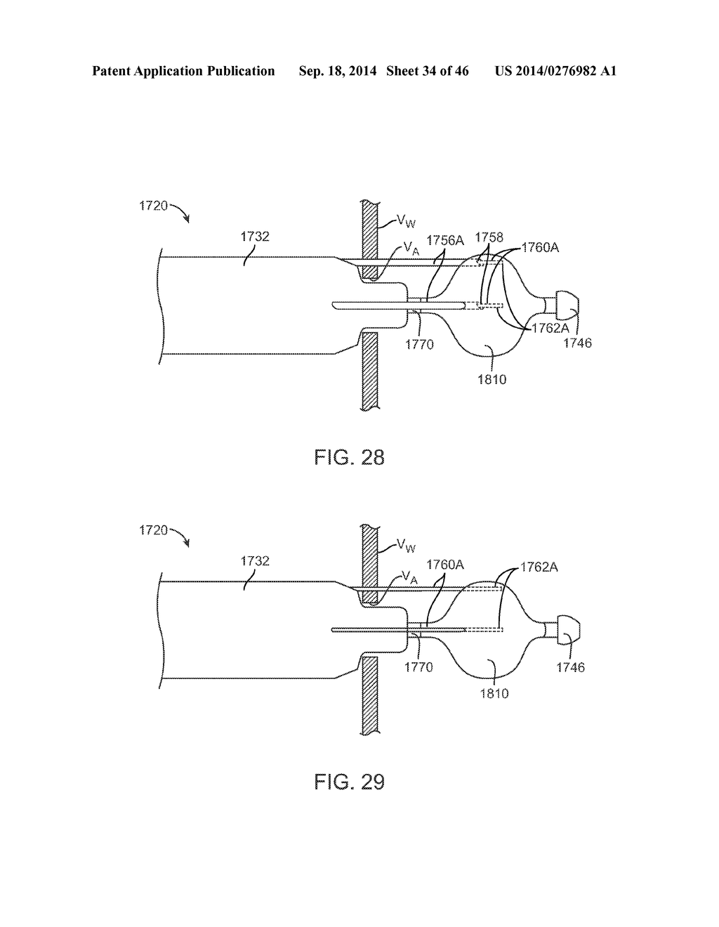 Suturing Device and Method for Sealing an Opening in a Blood Vessel or     Other Biological Structure - diagram, schematic, and image 35